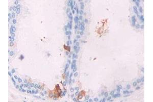DAB staining on IHC-P; Samples: Human Prostate Tissue (GREM1 抗体  (AA 26-184))