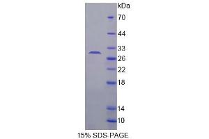 SDS-PAGE analysis of Mouse C/EBP delta Protein. (CEBPD 蛋白)