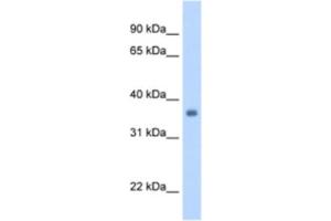 Western Blotting (WB) image for anti-Sarcoglycan, gamma (35kDa Dystrophin-Associated Glycoprotein) (SGCG) antibody (ABIN2462796) (SGCG 抗体)