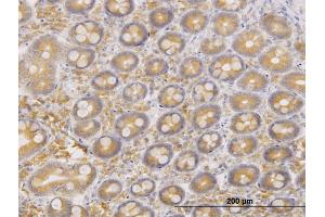 Immunostaining (ISt) image for anti-ERO1-Like Protein alpha (ERO1L) (AA 90-178) antibody (ABIN565458)