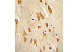 Immunohistochemistry analysis in formalin fixed and paraffin embedded human brain tissue reacted with MAPK8 / JNK1 Antibody (Thr183/Tyr185) followed which was peroxidase conjugated to the secondary antibody and followed by DAB staining. (JNK 抗体  (AA 162-199))
