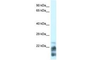 Image no. 1 for anti-Magnesium-Dependent Phosphatase 1 (MDP1) (N-Term) antibody (ABIN6742139) (MDP1 抗体  (N-Term))