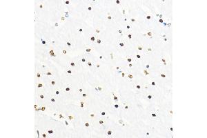 Immunohistochemistry of paraffin-embedded rat brain using ZEB2 Rabbit pAb (ABIN6131480, ABIN6150424, ABIN6150425 and ABIN6221369) at dilution of 1:100 (40x lens). (ZEB2 抗体  (AA 1050-1214))