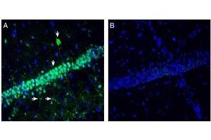 Expression of Neuromedin U Receptor 2 in rat hippocampus. (NMUR2 抗体  (Extracellular, N-Term))