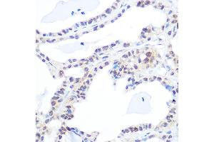 Immunohistochemistry (IHC) image for anti-Topoisomerase (DNA) I (TOP1) antibody (ABIN7270850)