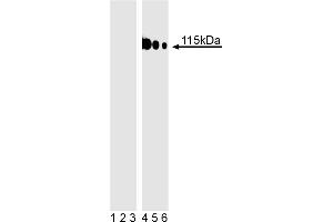 Western blot analysis of TBK1 (pS172) fusion protein.
