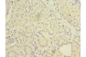 Immunohistochemistry of paraffin-embedded human pancreatic tissue using ABIN7175069 at dilution of 1: 100 (C2orf27A 抗体  (AA 3-174))