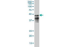 FOXA2 monoclonal antibody (M05), clone 6G9 Western Blot analysis of FOXA2 expression in HepG2 . (FOXA2 抗体  (AA 363-457))