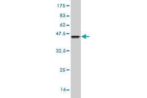 Western Blot detection against Immunogen (36. (GRB7 抗体  (AA 37-136))