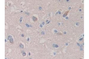 Immunohistochemistry (IHC) image for anti-Sema Domain, Immunoglobulin Domain (Ig), Short Basic Domain, Secreted, (Semaphorin) 3A (SEMA3A) (AA 580-664) antibody (ABIN7430102)