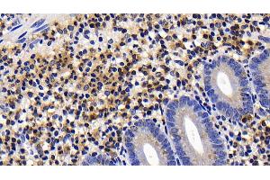 Detection of CASP9 in Human Appendix Tissue using Polyclonal Antibody to Caspase 9 (CASP9) (Caspase 9 抗体  (AA 331-416))