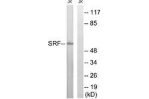 Western blot analysis of extracts from Jurkat cells, treated with insulin 0. (SRF 抗体  (AA 41-90))