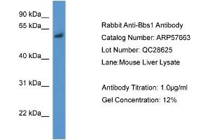 WB Suggested Anti-Bbs1  Antibody Titration: 0. (BBS1 抗体  (N-Term))