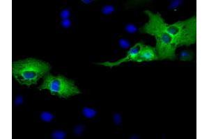 Immunofluorescence (IF) image for anti-Adenylate Kinase 5 (AK5) antibody (ABIN1496532) (Adenylate Kinase 5 抗体)