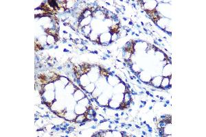 Immunohistochemistry of paraffin-embedded human colon using Peroxiredoxin 3 (PRDX3) (PRDX3) Rabbit mAb (ABIN7269237) at dilution of 1:100 (40x lens). (Peroxiredoxin 3 抗体)
