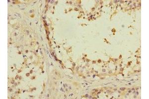Immunohistochemistry (IHC) image for anti-Ankyrin Repeat and Sterile alpha Motif Domain Containing 1B (ANKS1B) (AA 999-1248) antibody (ABIN7144208)
