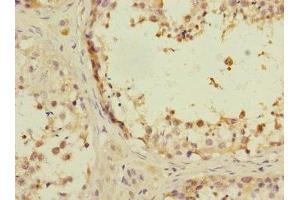 Immunohistochemistry of paraffin-embedded human testis tissue using ABIN7144208 at dilution of 1:100 (ANKS1B 抗体  (AA 999-1248))