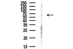 anti-EPS8-Like 1 (EPS8L1) antibody