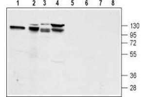 Western blot analysis of rat pancreas lysate (lanes 1 and 5), mouse preadipocyte 3T3-L1 lysate (lanes 2 and 6), rat pancreatic islet cell line  lysate (lanes 3 and 7) and human pancreatic carcinoma  lysate (lanes 4 and 8):1-4. (Glucagon-Like Peptide 1 Receptor (GLP1R) Peptide)