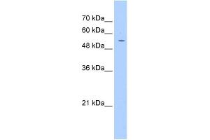 WB Suggested Anti-PGS1 Antibody Titration:  1. (PGS1 抗体  (C-Term))