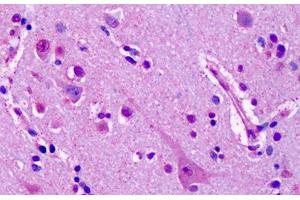 Anti-GRM7 / MGLUR7 antibody IHC staining of human brain, cortex, neurons. (GRM7 抗体  (Extracellular Domain))