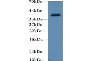 Detection of UCP4 in Porcine Cerebrum lysate using Polyclonal Antibody to Uncoupling Protein 4, Mitochondrial (UCP4) (SLC25A27 抗体  (AA 21-317))