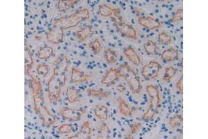 Used in DAB staining on fromalin fixed paraffin- embedded kidney tissue (CD320 抗体  (AA 36-256))