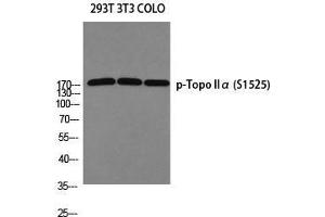 Western Blot (WB) analysis of 293T 3T3 COLO205 using p-Topo IIalpha (S1525) antibody. (Topo IIalpha (pSer1525) 抗体)