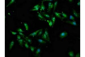 Immunofluorescence staining of Hela cells with ABIN7148551 at 1:100, counter-stained with DAPI.