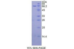 SDS-PAGE (SDS) image for Telomerase Reverse Transcriptase (TERT) (AA 787-1084) protein (His tag,GST tag) (ABIN1877400)