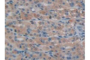 DAB staining on IHC-P; Samples: Rat Intestine Tissue (LCN8 抗体  (AA 25-176))