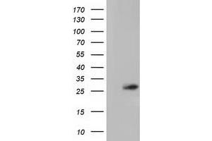 Western Blotting (WB) image for anti-OTU Domain, Ubiquitin Aldehyde Binding 2 (OTUB2) antibody (ABIN1499940) (OTUB2 抗体)