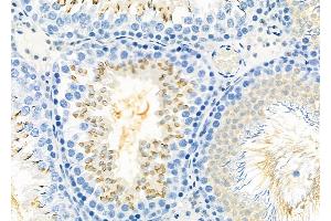 ABIN6260299 and ABIN6277920 at 1/100 staining Rat testis tissue by IHC-P. (BSP 抗体  (Internal Region))