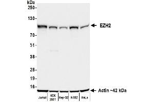 Western Blotting (WB) image for anti-Enhancer of Zeste Homolog 2 (EZH2) (AA 1-154) antibody (ABIN7795766)