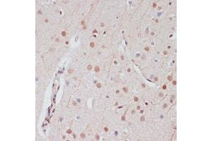 Immunohistochemistry (IHC) image for anti-cAMP Responsive Element Binding Protein 1 (CREB1) (AA 1-341) antibody (ABIN7266053)