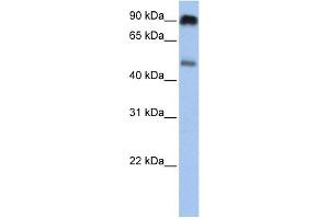 WB Suggested Anti-SLC45A2 Antibody Titration:  0. (SLC45A2 抗体  (C-Term))