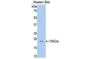 Western Blotting (WB) image for anti-Protein C Receptor, Endothelial (PROCR) (AA 32-167) antibody (ABIN1172003) (PROCR 抗体  (AA 32-167))