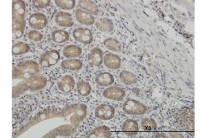 Immunoperoxidase of monoclonal antibody to NMI on formalin-fixed paraffin-embedded human small Intestine. (NMI 抗体  (AA 1-100))