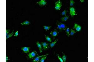 Immunofluorescent analysis of HepG2 cells using ABIN7171273 at dilution of 1:100 and Alexa Fluor 488-congugated AffiniPure Goat Anti-Rabbit IgG(H+L) (SDCBP 抗体  (AA 21-228))