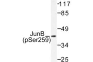 Image no. 1 for anti-Jun B Proto-Oncogene (JUNB) (pSer259) antibody (ABIN318057) (JunB 抗体  (pSer259))