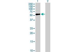Western Blot analysis of ZNF436 expression in transfected 293T cell line by ZNF436 MaxPab polyclonal antibody. (ZNF436 抗体  (AA 1-470))