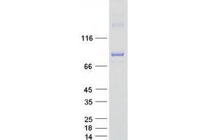 Western Blotting (WB) image for TANK-Binding Kinase 1 (TBK1) protein (Myc-DYKDDDDK Tag) (ABIN2712379)
