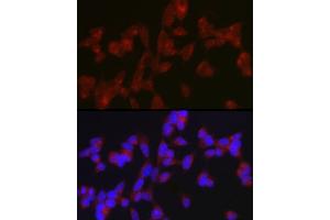 Immunofluorescence analysis of SH-SY5Y cells using A Rabbit pAb (ABIN7265712) at dilution of 1:150 (40x lens). (ATG9A 抗体  (AA 180-290))