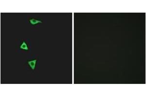 Immunofluorescence analysis of LOVO cells, using BDKRB1 Antibody. (BDKRB1 抗体  (AA 201-250))