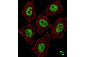 Immunofluorescent analysis of A549 cells, using XRCC1 Antibody . (XRCC1 抗体  (AA 407-435))