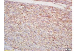 Formalin-fixed and paraffin embedded mouse embryo labeled with Rabbit Anti p38MAPK/MAPK14/p38Alpha Polyclonal Antibody, Unconjugated (ABIN671241) at 1:200 followed by conjugation to the secondary antibody and DAB staining (MAPK14 抗体  (AA 141-240))