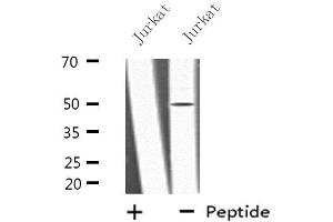 Western blot analysis of extracts from Jurkat cells, using LRP11 antibody. (LRP11 抗体  (Internal Region))