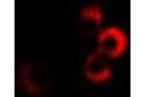 Immunofluorescent analysis of CPT2 staining in MCF7 cells. (CPT2 抗体)