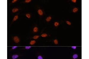 Immunofluorescence analysis of U-2 OS cells using SRSF7 Polyclonal Antibody at dilution of 1:100. (SFRS7 抗体)