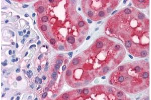 Human Kidney: Formalin-Fixed, Paraffin-Embedded (FFPE) (RRM2 抗体  (AA 1-111))